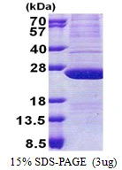 3microg Human ATP5H protein (GTX68159-pro) by SDS-PAGE under reducing condition and visualized by coomassie blue stain. 3microg Human ATP5H protein (GTX68159-pro) by SDS-PAGE under reducing condition and visualized by coomassie blue stain.