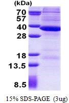 3µg Human RNAse H2A protein (GTX68166-pro) by SDS-PAGE under reducing condition and visualized by coomassie blue stain.