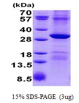 3?g Human POP4 protein (GTX68192-pro) by SDS-PAGE under reducing condition and visualized by coomassie blue stain.