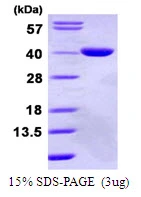 3?g Human GPD1L protein (GTX68315-pro) by SDS-PAGE under reducing condition and visualized by coomassie blue stain.