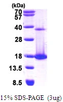 3?g Human COTL1 protein (GTX68321-pro) by SDS-PAGE under reducing condition and visualized by coomassie blue stain.