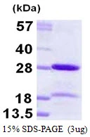 3microg Human HP1 alpha protein (GTX68328-pro) by SDS-PAGE under reducing condition and visualized by coomassie blue stain. 3microg Human HP1 alpha protein (GTX68328-pro) by SDS-PAGE under reducing condition and visualized by coomassie blue stain.