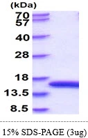 3microg Rat L-FABP protein (GTX68352-pro) by SDS-PAGE under reducing condition and visualized by coomassie blue stain. 3microg Rat L-FABP protein (GTX68352-pro) by SDS-PAGE under reducing condition and visualized by coomassie blue stain.