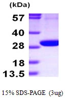 3microg Human PGLS protein (GTX68353-pro) by SDS-PAGE under reducing condition and visualized by coomassie blue stain. 3microg Human PGLS protein (GTX68353-pro) by SDS-PAGE under reducing condition and visualized by coomassie blue stain.
