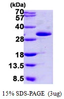 3microg Human Grancalcin protein (GTX68354-pro) by SDS-PAGE under reducing condition and visualized by coomassie blue stain. 3microg Human Grancalcin protein (GTX68354-pro) by SDS-PAGE under reducing condition and visualized by coomassie blue stain.