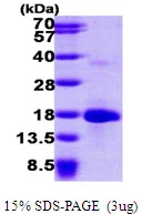 3microg Human LSM4 protein (GTX68355-pro) by SDS-PAGE under reducing condition and visualized by coomassie blue stain. 3microg Human LSM4 protein (GTX68355-pro) by SDS-PAGE under reducing condition and visualized by coomassie blue stain.