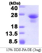 3microg Human ASF1A protein (GTX68357-pro) by SDS-PAGE under reducing condition and visualized by coomassie blue stain. 3microg Human ASF1A protein (GTX68357-pro) by SDS-PAGE under reducing condition and visualized by coomassie blue stain.