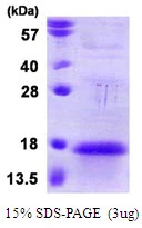 3microg Human APC13 protein (GTX68359-pro) by SDS-PAGE under reducing condition and visualized by coomassie blue stain. 3microg Human APC13 protein (GTX68359-pro) by SDS-PAGE under reducing condition and visualized by coomassie blue stain.