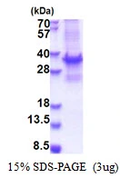 3microg Human BRMS1 protein (GTX68360-pro) by SDS-PAGE under reducing condition and visualized by coomassie blue stain. 3microg Human BRMS1 protein (GTX68360-pro) by SDS-PAGE under reducing condition and visualized by coomassie blue stain.