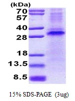 3microg Human Pirh2 protein (GTX68361-pro) by SDS-PAGE under reducing condition and visualized by coomassie blue stain. 3microg Human Pirh2 protein (GTX68361-pro) by SDS-PAGE under reducing condition and visualized by coomassie blue stain.