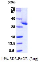 3microg Human CLIC4 protein (GTX68363-pro) by SDS-PAGE under reducing condition and visualized by coomassie blue stain. 3microg Human CLIC4 protein (GTX68363-pro) by SDS-PAGE under reducing condition and visualized by coomassie blue stain.