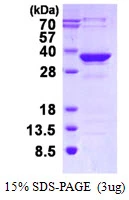 3microg Human MMACHC protein (GTX68367-pro) by SDS-PAGE under reducing condition and visualized by coomassie blue stain. 3microg Human MMACHC protein (GTX68367-pro) by SDS-PAGE under reducing condition and visualized by coomassie blue stain.