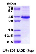 3?g Human FBXO6 protein (GTX68378-pro) by SDS-PAGE under reducing condition and visualized by coomassie blue stain.