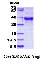 3microg Human EHF protein (GTX68381-pro) by SDS-PAGE under reducing condition and visualized by coomassie blue stain. 3microg Human EHF protein (GTX68381-pro) by SDS-PAGE under reducing condition and visualized by coomassie blue stain.