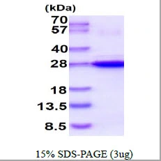 3microg Human HSP22 protein (GTX68382-pro) by SDS-PAGE under reducing condition and visualized by coomassie blue stain. 3microg Human HSP22 protein (GTX68382-pro) by SDS-PAGE under reducing condition and visualized by coomassie blue stain.