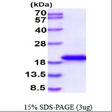 3microg Human IL1F5 protein (GTX68383-pro) by SDS-PAGE under reducing condition and visualized by coomassie blue stain. 3microg Human IL1F5 protein (GTX68383-pro) by SDS-PAGE under reducing condition and visualized by coomassie blue stain.