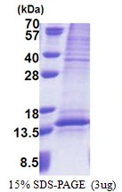 3microg Human UQCRQ protein (GTX68390-pro) by SDS-PAGE under reducing condition and visualized by coomassie blue stain. 3microg Human UQCRQ protein (GTX68390-pro) by SDS-PAGE under reducing condition and visualized by coomassie blue stain.