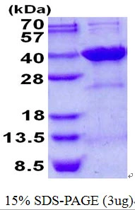 3microg Human Syntenin 2 protein (GTX68393-pro) by SDS-PAGE under reducing condition and visualized by coomassie blue stain. 3microg Human Syntenin 2 protein (GTX68393-pro) by SDS-PAGE under reducing condition and visualized by coomassie blue stain.