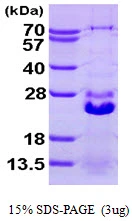 3microg Human HSPB7 protein (GTX68394-pro) by SDS-PAGE under reducing condition and visualized by coomassie blue stain. 3microg Human HSPB7 protein (GTX68394-pro) by SDS-PAGE under reducing condition and visualized by coomassie blue stain.