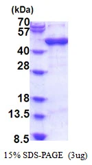 3microg Human ARFIP1 protein (GTX68399-pro) by SDS-PAGE under reducing condition and visualized by coomassie blue stain. 3microg Human ARFIP1 protein (GTX68399-pro) by SDS-PAGE under reducing condition and visualized by coomassie blue stain.