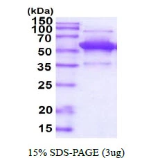 3microg Human PDCD4 protein (GTX68404-pro) by SDS-PAGE under reducing condition and visualized by coomassie blue stain. 3microg Human PDCD4 protein (GTX68404-pro) by SDS-PAGE under reducing condition and visualized by coomassie blue stain.