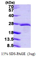 3microg Human EIF3K protein (GTX68412-pro) by SDS-PAGE under reducing condition and visualized by coomassie blue stain. 3microg Human EIF3K protein (GTX68412-pro) by SDS-PAGE under reducing condition and visualized by coomassie blue stain.