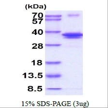 3&#956;g Human DNA polymerase lambda protein (GTX68414-pro) by SDS-PAGE under reducing condition and visualized by coomassie blue stain.