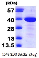 3microg Human MAT2B protein (GTX68416-pro) by SDS-PAGE under reducing condition and visualized by coomassie blue stain. 3microg Human MAT2B protein (GTX68416-pro) by SDS-PAGE under reducing condition and visualized by coomassie blue stain.