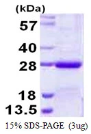 3microg Human NKIRAS2 protein (GTX68417-pro) by SDS-PAGE under reducing condition and visualized by coomassie blue stain. 3microg Human NKIRAS2 protein (GTX68417-pro) by SDS-PAGE under reducing condition and visualized by coomassie blue stain.