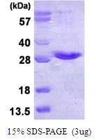 3microg Human NKIRAS1 protein (GTX68418-pro) by SDS-PAGE under reducing condition and visualized by coomassie blue stain. 3microg Human NKIRAS1 protein (GTX68418-pro) by SDS-PAGE under reducing condition and visualized by coomassie blue stain.