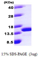 3microg Human LAMTOR2 protein (GTX68419-pro) by SDS-PAGE under reducing condition and visualized by coomassie blue stain. 3microg Human LAMTOR2 protein (GTX68419-pro) by SDS-PAGE under reducing condition and visualized by coomassie blue stain.