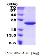 3microg Human MCTS1 protein (GTX68422-pro) by SDS-PAGE under reducing condition and visualized by coomassie blue stain. 3microg Human MCTS1 protein (GTX68422-pro) by SDS-PAGE under reducing condition and visualized by coomassie blue stain.