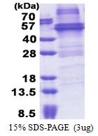 3microg Human NOB1 protein (GTX68423-pro) by SDS-PAGE under reducing condition and visualized by coomassie blue stain. 3microg Human NOB1 protein (GTX68423-pro) by SDS-PAGE under reducing condition and visualized by coomassie blue stain.