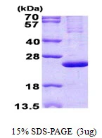3microg Human MRPL13 protein (GTX68424-pro) by SDS-PAGE under reducing condition and visualized by coomassie blue stain. 3microg Human MRPL13 protein (GTX68424-pro) by SDS-PAGE under reducing condition and visualized by coomassie blue stain.