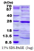 3microg Human HRPAP20 protein (GTX68425-pro) by SDS-PAGE under reducing condition and visualized by coomassie blue stain. 3microg Human HRPAP20 protein (GTX68425-pro) by SDS-PAGE under reducing condition and visualized by coomassie blue stain.