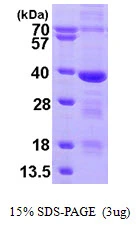 3microg Human MED4 protein (GTX68426-pro) by SDS-PAGE under reducing condition and visualized by coomassie blue stain. 3microg Human MED4 protein (GTX68426-pro) by SDS-PAGE under reducing condition and visualized by coomassie blue stain.