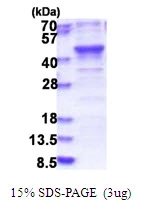3microg Human HSPC142 protein (GTX68428-pro) by SDS-PAGE under reducing condition and visualized by coomassie blue stain. 3microg Human HSPC142 protein (GTX68428-pro) by SDS-PAGE under reducing condition and visualized by coomassie blue stain.