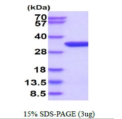 3microg Human THYN1 protein (GTX68429-pro) by SDS-PAGE under reducing condition and visualized by coomassie blue stain. 3microg Human THYN1 protein (GTX68429-pro) by SDS-PAGE under reducing condition and visualized by coomassie blue stain.