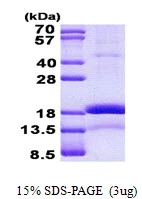 3&#956;g Human CHRAC1 protein (GTX68543-pro) by SDS-PAGE under reducing condition and visualized by coomassie blue stain.