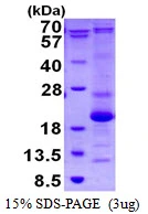 3?g Human ASF1B protein (GTX68608-pro) by SDS-PAGE under reducing condition and visualized by coomassie blue stain.