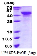 3microg Human NDRG2 protein (GTX68661-pro) by SDS-PAGE under reducing condition and visualized by coomassie blue stain. 3microg Human NDRG2 protein (GTX68661-pro) by SDS-PAGE under reducing condition and visualized by coomassie blue stain.