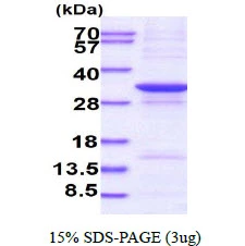 3microg Human AADACL1 protein (GTX68662-pro) by SDS-PAGE under reducing condition and visualized by coomassie blue stain. 3microg Human AADACL1 protein (GTX68662-pro) by SDS-PAGE under reducing condition and visualized by coomassie blue stain.