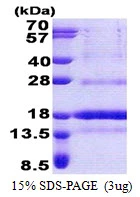 3microg Human POLD4 protein (GTX68667-pro) by SDS-PAGE under reducing condition and visualized by coomassie blue stain. 3microg Human POLD4 protein (GTX68667-pro) by SDS-PAGE under reducing condition and visualized by coomassie blue stain.