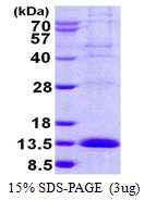 3microg Human LSM2 protein (GTX68668-pro) by SDS-PAGE under reducing condition and visualized by coomassie blue stain. 3microg Human LSM2 protein (GTX68668-pro) by SDS-PAGE under reducing condition and visualized by coomassie blue stain.