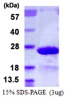 3microg Human MYL7 protein (GTX68673-pro) by SDS-PAGE under reducing condition and visualized by coomassie blue stain. 3microg Human MYL7 protein (GTX68673-pro) by SDS-PAGE under reducing condition and visualized by coomassie blue stain.