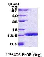 3microg Human ABRACL protein (GTX68674-pro) by SDS-PAGE under reducing condition and visualized by coomassie blue stain. 3microg Human ABRACL protein (GTX68674-pro) by SDS-PAGE under reducing condition and visualized by coomassie blue stain.