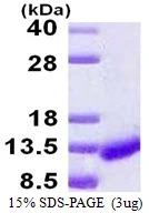 3microg Human ICEBERG protein (GTX68677-pro) by SDS-PAGE under reducing condition and visualized by coomassie blue stain. 3microg Human ICEBERG protein (GTX68677-pro) by SDS-PAGE under reducing condition and visualized by coomassie blue stain.