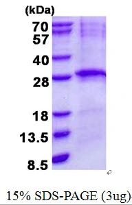 3?g Human LIN7B protein (GTX68693-pro) by SDS-PAGE under reducing condition and visualized by coomassie blue stain.