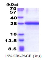 3microg Human OBFC2A protein (GTX68706-pro) by SDS-PAGE under reducing condition and visualized by coomassie blue stain. 3microg Human OBFC2A protein (GTX68706-pro) by SDS-PAGE under reducing condition and visualized by coomassie blue stain.