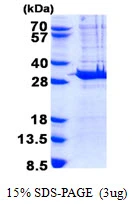 3microg Human PYCRL protein (GTX68708-pro) by SDS-PAGE under reducing condition and visualized by coomassie blue stain. 3microg Human PYCRL protein (GTX68708-pro) by SDS-PAGE under reducing condition and visualized by coomassie blue stain.